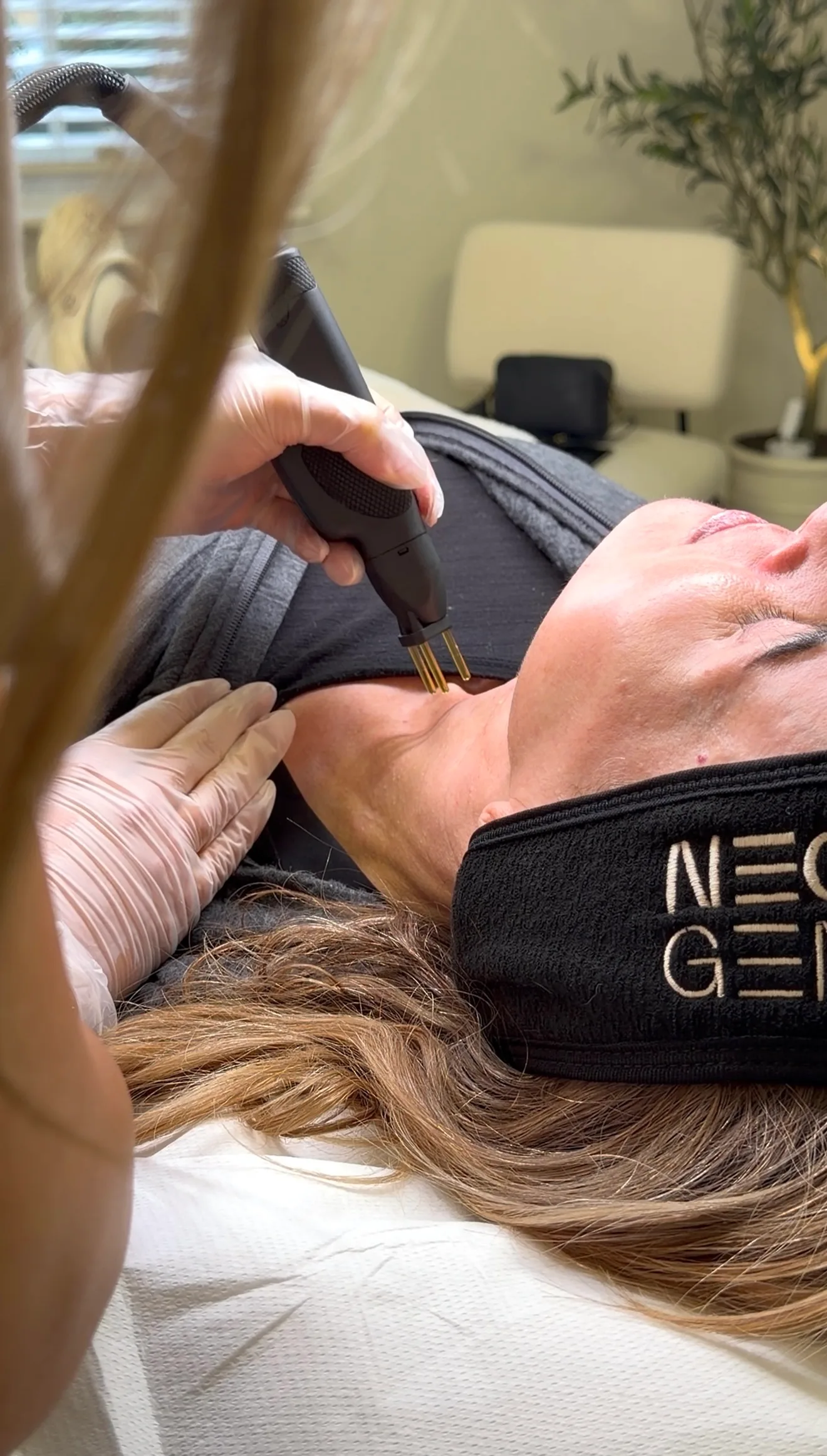 NeoGen Plasma treatment in progress at LovesSkin clinic