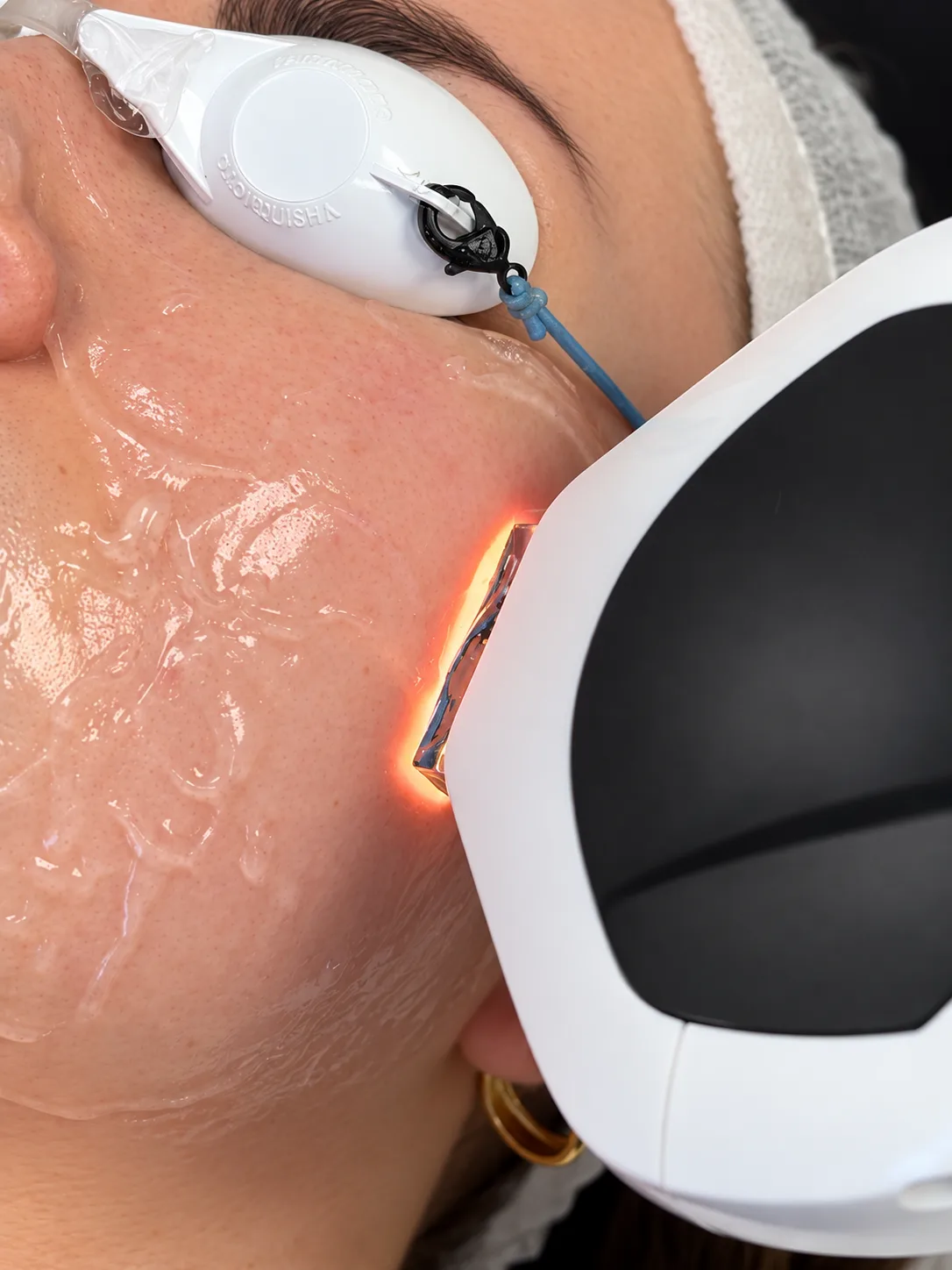 Lumecca IPL handpiece applying light to skin surface